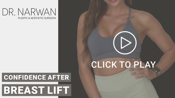 Thumbnail Video Breast Surgery Result, Dr. Narwan, Plastic and Aesthetic Surgery Dubai