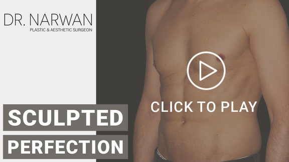 Thumbnail Video Sculpted Perfection, Dr. Narwan, Plastic and Aesthetic Surgery Dubai