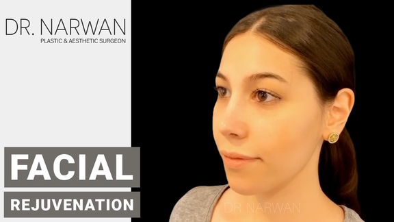 Thumbnail Video Facial Rejuvenation, Dr. Narwan, Plastic and Aesthetic Surgery Dubai