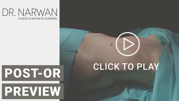 Thumbnail Video Post-Or Preview, Dr. Narwan, Plastic and Aesthetic Surgery Dubai