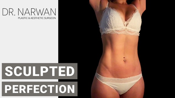 Thumbnail Video Sculpted Perfection, Dr. Narwan, Plastic and Aesthetic Surgery Dubai