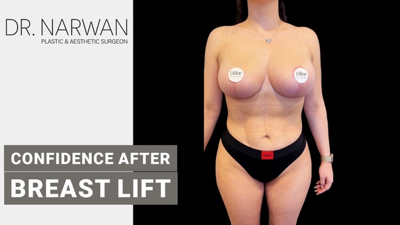 Thumbnail Video Breast Lift, Dr. Narwan, Plastic and Aesthetic Surgery Dubai