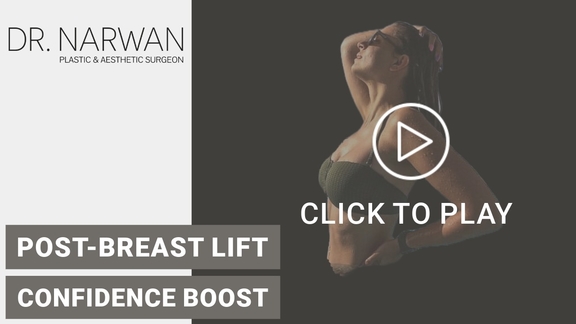 Thumbnail Video Breast Surgery Result, Dr. Narwan, Plastic and Aesthetic Surgery Dubai