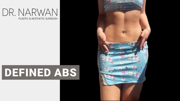 Thumbnail Video Defined Abs, Dr. Narwan, Plastic and Aesthetic Surgery Dubai