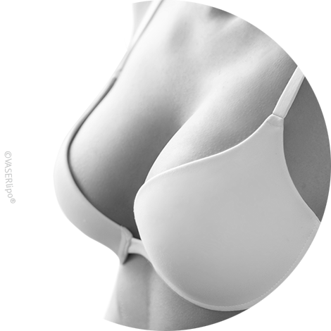 Breast surgery, Dr. Narwan, Plastic and Aesthetic Surgery Dubai